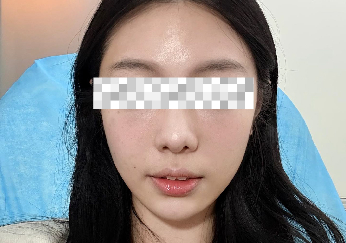 After